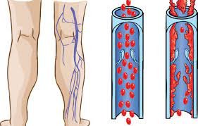 Vascular surgery department